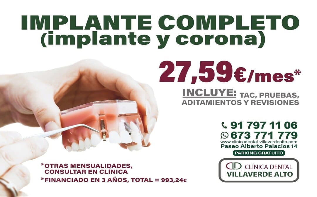 Promoción implante dental pago mensual