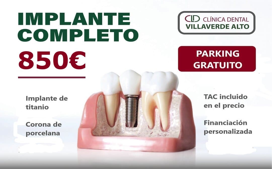 Promoción implante dental completo
